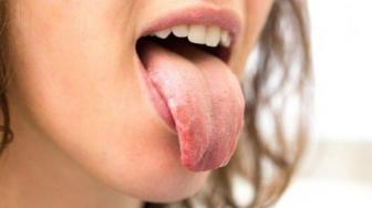 Why Is My Tongue White? 4 Reasons You Need To Know